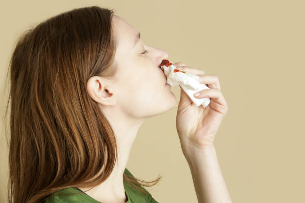 Nosebleeds Causes and Treatments